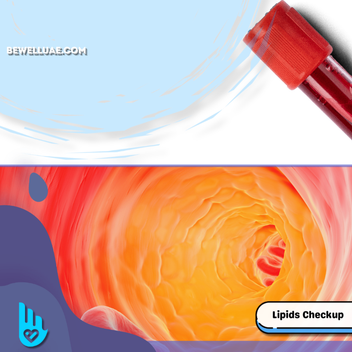 Hyperlipidemia Checkup